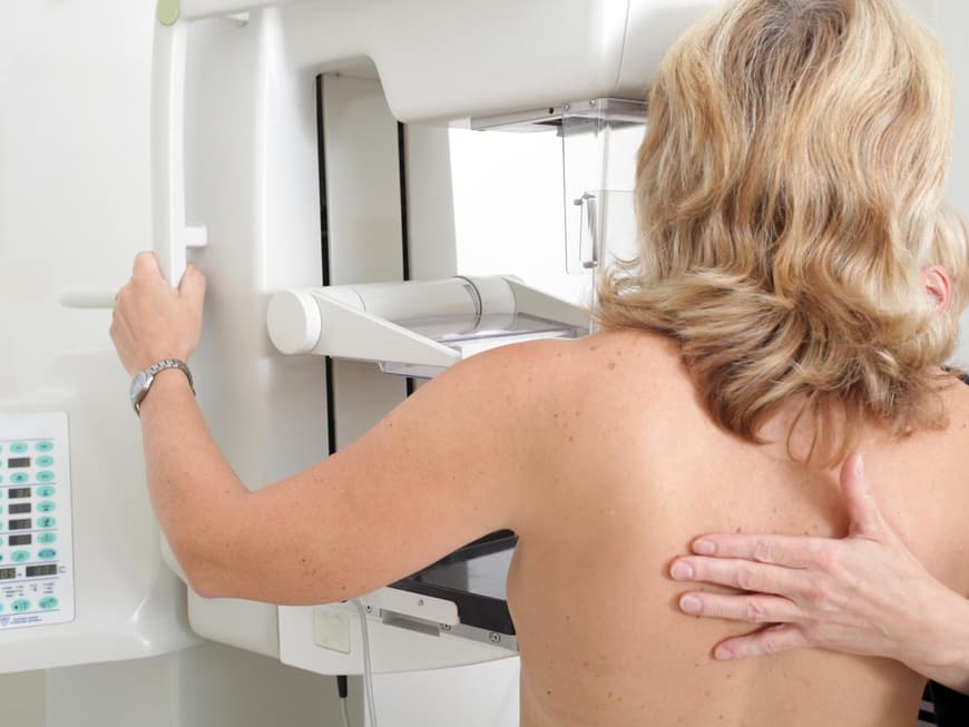 Brustkrebs wird meist bei Mammographie-Untersuchungen entdeckt