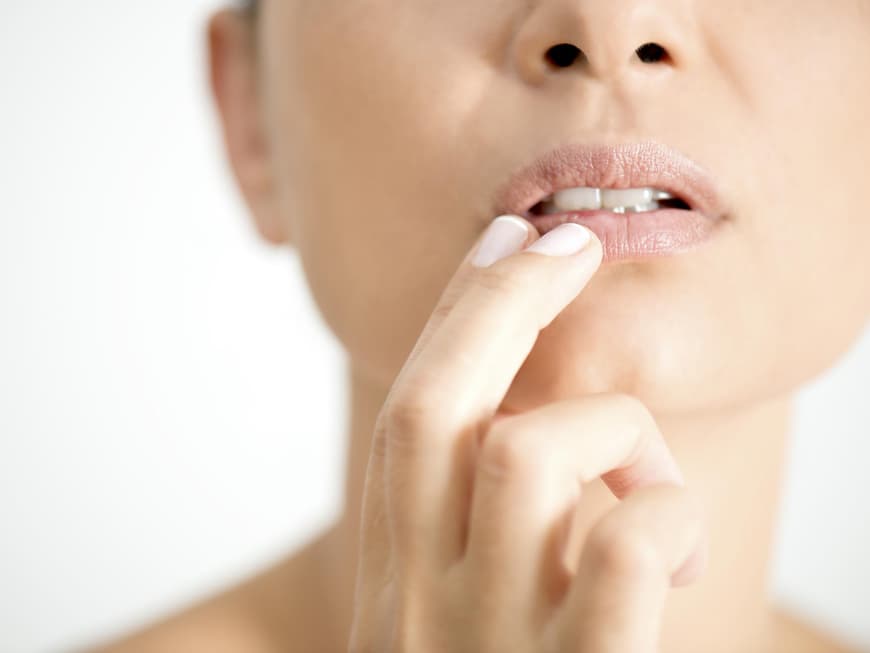 Lippenherpes ist unangenehm - So kann er behandelt werden