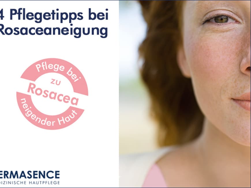 Typische Merkmale für Rosacea sind erweiterte Äderchen und Rötungen im Gesicht. 