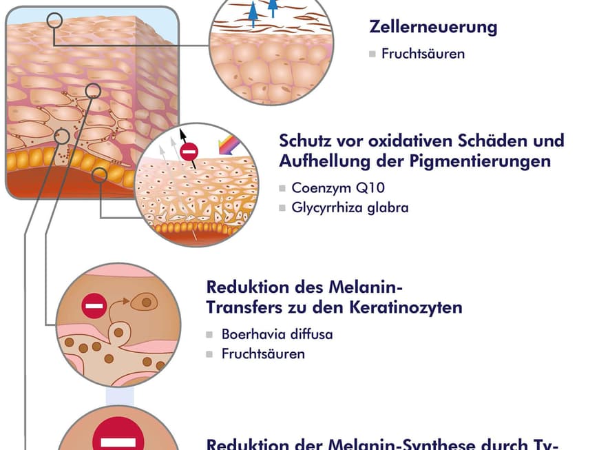 So funktioniert das Pflege-Konzept für die Reduktion des Melanin-Stoffwechsels