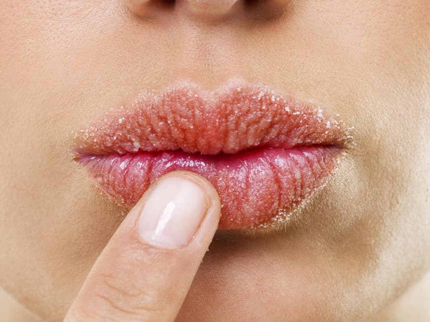 Was hilft bei spröden Lippen?
