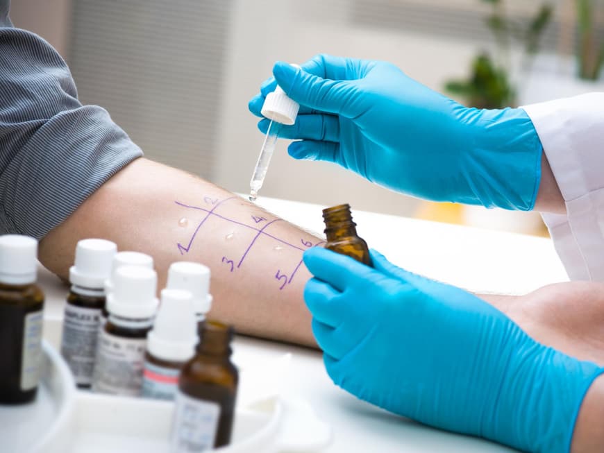 Prick Test beim Arzt