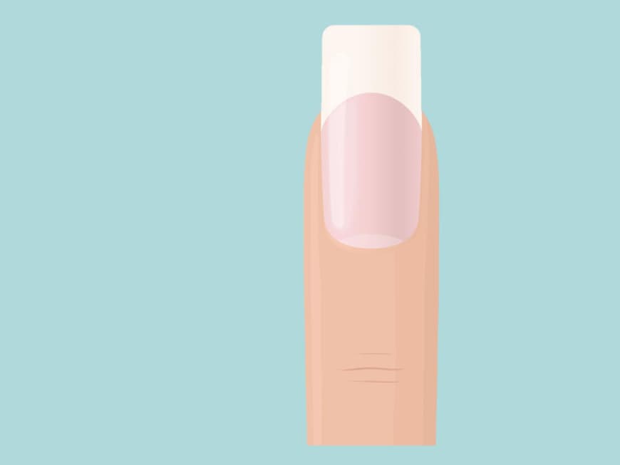 Illustration eines Fingers mit eckiger Fingernagelspitze