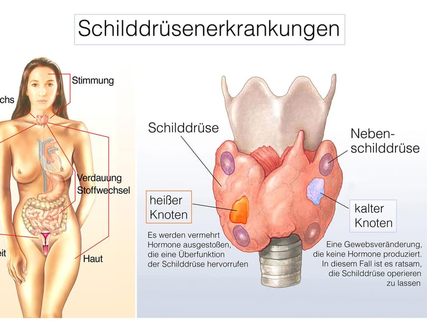 Funktion der Schilddrüse anhand einer Grafik