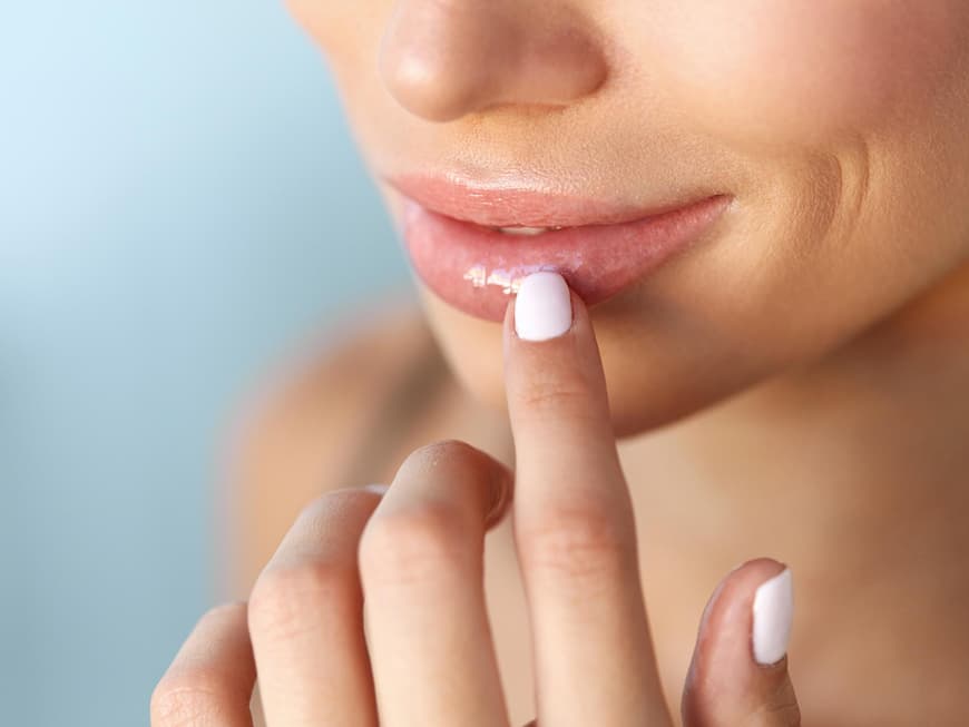 Trockene Lippen brauchen intensive Pflege