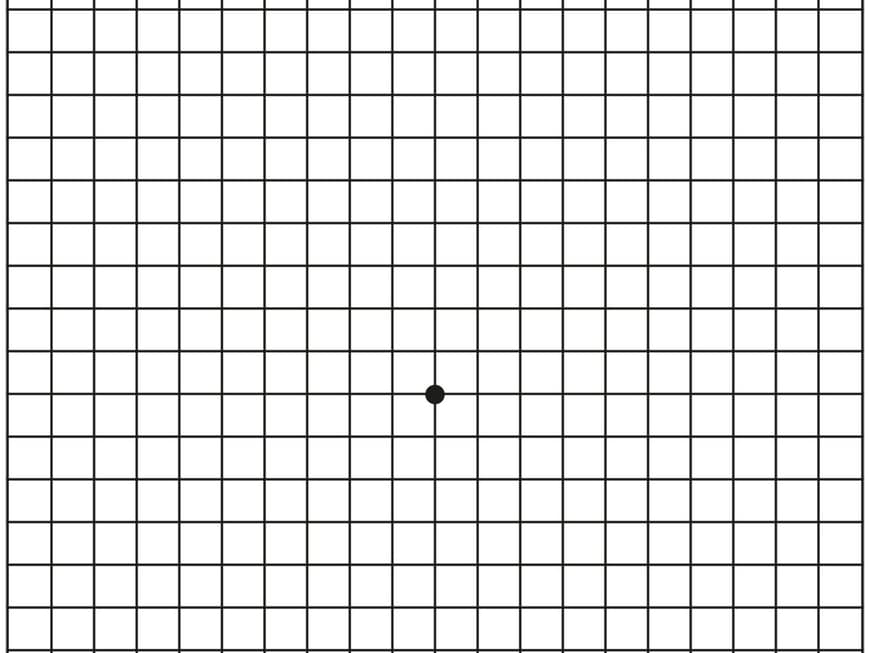 Mit dem Amsler-Gitter-Test können Sie Ihre Augen testen