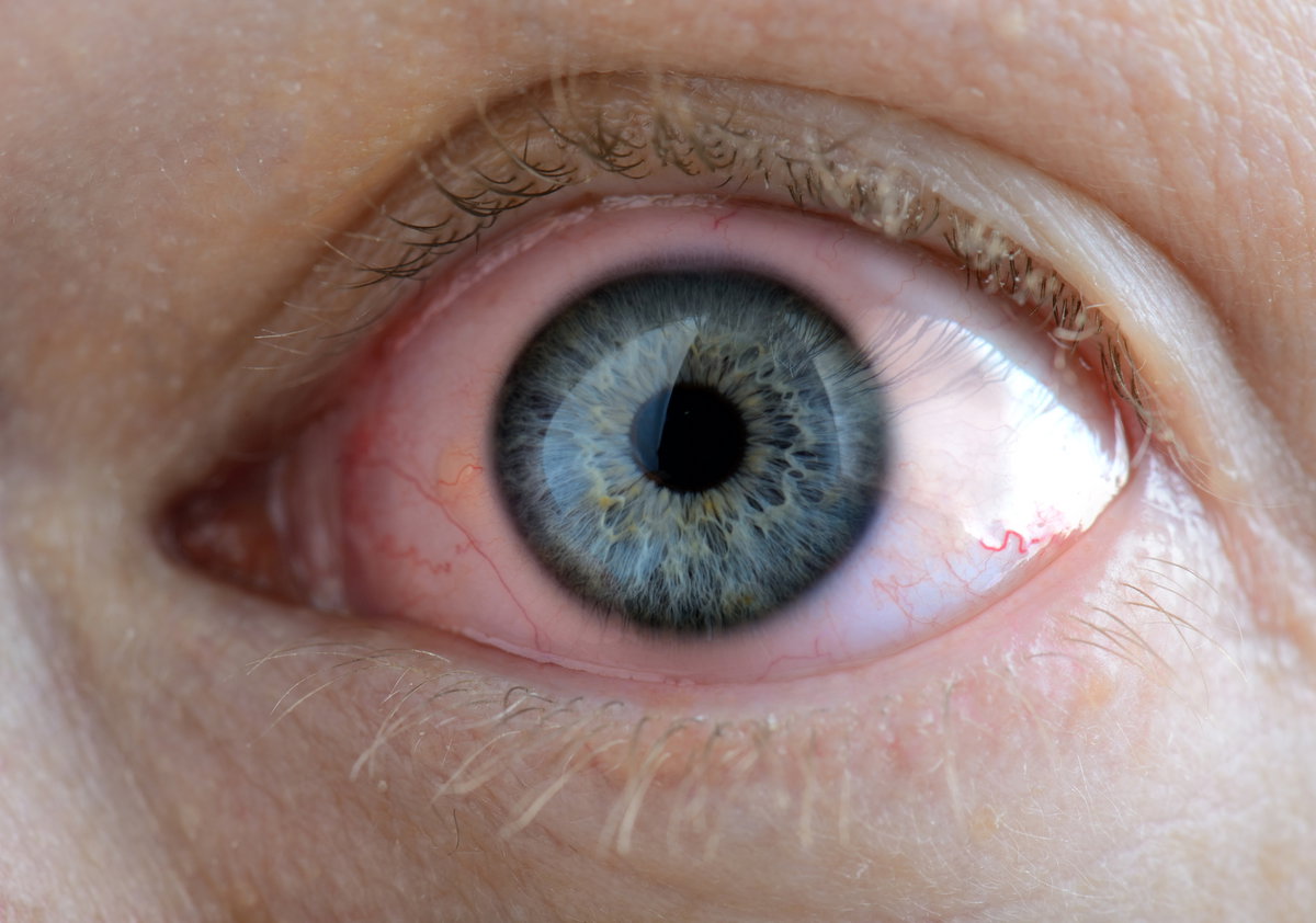 Was Unsere Augen In Sachen Gesundheit Verraten