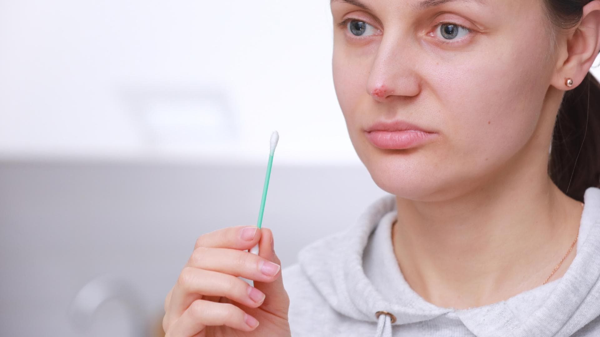 Herpes an der Nase Verlauf, Symptome und Behandlung
